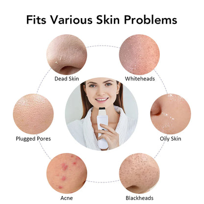 Ultrasonic Skin Scrubber - 4 Modes Facial Lifting Device